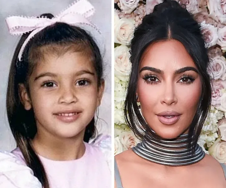 Kim transformation from Childhood and now